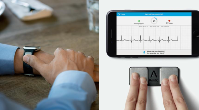 Une start-up lève plus de 30 millions de dollars pour sa plateforme intelligente de prévention d'AVC