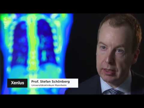 "L’homme rendu superflu par l’intelligence artificielle ?" - Reportage de l'émission Xenius