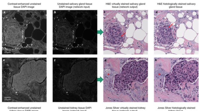 Un algorithme de deep learning pour optimiser le processus de coloration des tissus utilisé en histopathologie