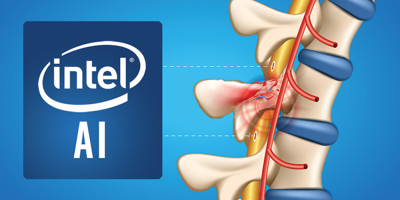 Intel et l’Université de Brown dévoilent leur projet d’interface intelligente pour les personnes paralysées