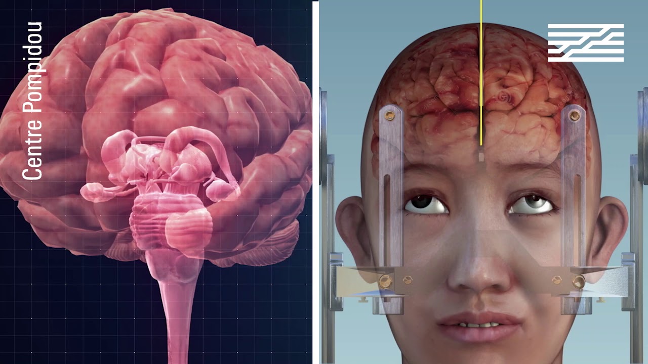 « Neurones, les intelligences simulées » - la nouvelle exposition du Centre Pompidou