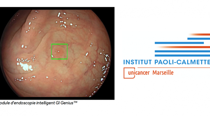 L'Institut Paoli-Calmettes met en service GeniusTM Medtronic, système d’intelligence artificielle pour détecter les polypes colorectaux