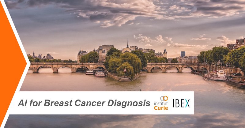 L'Institut Curie signe un partenariat avec Ibex Medical Analytics pour améliorer la détection du cancer du sein grâce à l'IA