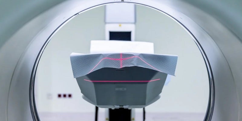 Le Centre Léon Bérard va piloter trois projets utilisant l'IA pour améliorer les radiothérapies