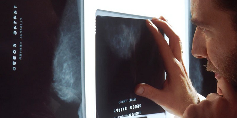 L'American College of Radiology publie une enquête sur les usages de l'intelligence artificielle en radiologie