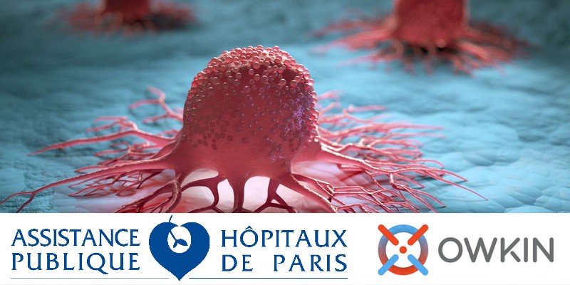Intelligence artificielle, oncologie et immunologie : AP-HP et Owkin présentent leurs résultats