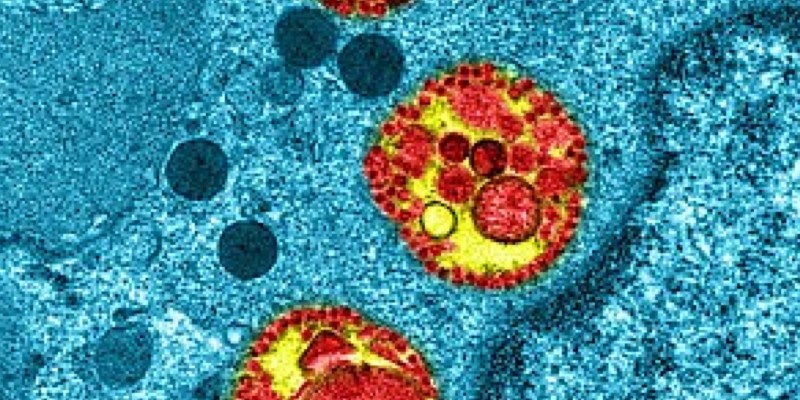 ADAM9, un gène potentiellement impliqué dans les formes graves de Covid-19 identifié par l'intelligence artificielle