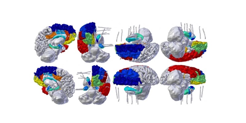 La maîtrise de soi et la flexibilité mentale améliorées par l’intelligence artificielle et la stimulation électrique