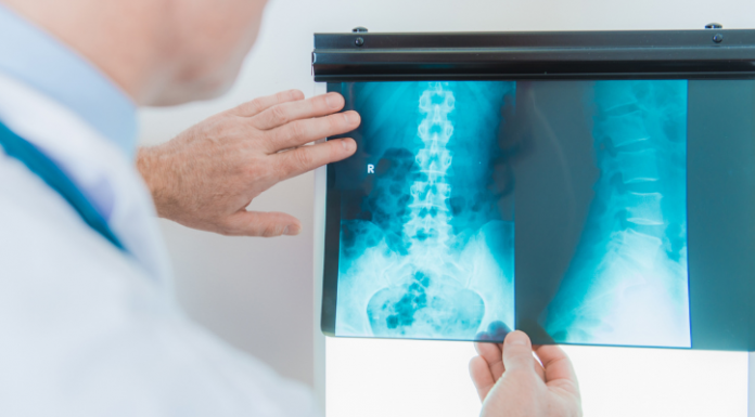 Incepto et Stephanix s'associent pour intégrer des solutions innovantes d'IA à l'imagerie médicale