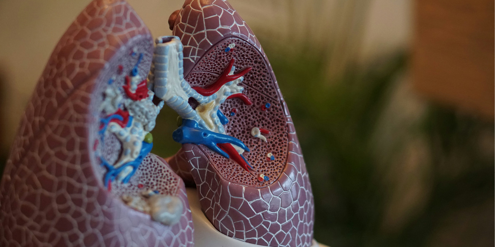 AdvanThink et l'Inserm UMR-S 999 s'associent pour lutter contre l'hypertension artérielle pulmonaire